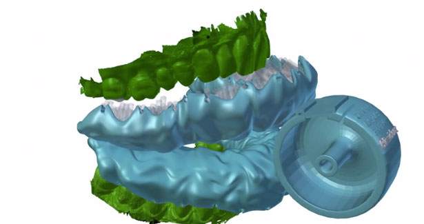 Blizzident 3 D Printed Toothbrush
