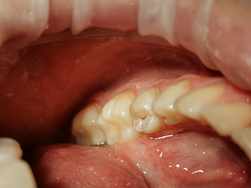 Img 20220403 160210